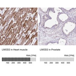 Invitrogen LMOD2 Polyclonal Antibody 100 &mu;L; Unconjugated:Antibodies,