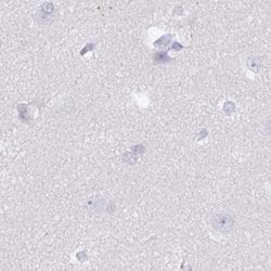 Invitrogen SPESP1 Polyclonal Antibody 100 &mu;L; Unconjugated:Antibodies,