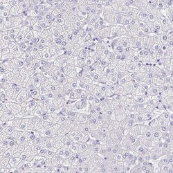 Invitrogen TMPRSS11E Polyclonal Antibody 100 &mu;L | Buy Online | Invitrogen&trade; | Fisher Scientific