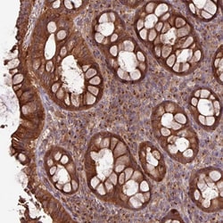 Invitrogen RAB19 Polyclonal Antibody 100 &mu;L; Unconjugated:Antibodies,