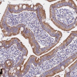 Invitrogen MRPS14 Polyclonal Antibody 100 &mu;L; Unconjugated:Antibodies,