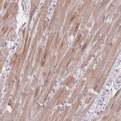 Invitrogen MRPS14 Polyclonal Antibody 100 &mu;L; Unconjugated:Antibodies,