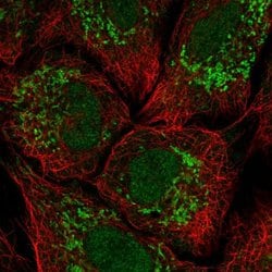 Invitrogen KCNH3 Polyclonal Antibody 100 &mu;L; Unconjugated:Antibodies,