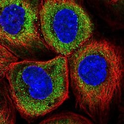 Invitrogen RNF23 Polyclonal Antibody 100 &mu;L | Buy Online | Invitrogen&trade; | Fisher Scientific