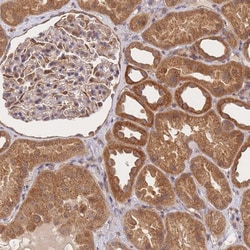Invitrogen ST8SIA4 Polyclonal Antibody 100 &mu;L; Unconjugated:Antibodies,