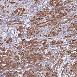 Invitrogen TIAF1 Polyclonal Antibody 100 &mu;L; Unconjugated:Antibodies,