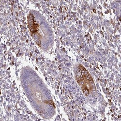 Invitrogen ZNF835 Polyclonal Antibody 100 &mu;L; Unconjugated:Antibodies,