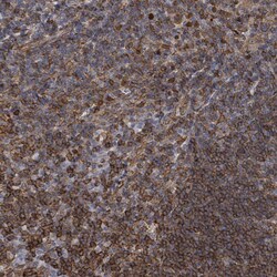 Invitrogen PRKRIP1 Polyclonal Antibody 100 &mu;L; Unconjugated:Antibodies,