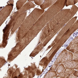 Invitrogen ART1 Polyclonal Antibody 100 &mu;L | Buy Online | Invitrogen&trade; | Fisher Scientific