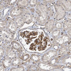 Invitrogen KANK3 Polyclonal Antibody 100 &mu;L; Unconjugated:Antibodies,