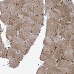 Invitrogen KANK3 Polyclonal Antibody 100 &mu;L; Unconjugated:Antibodies,