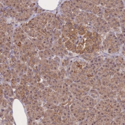Invitrogen Meteorin Polyclonal Antibody 100 &mu;L; Unconjugated:Antibodies,