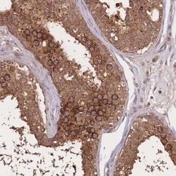 Invitrogen Meteorin Polyclonal Antibody 100 &mu;L; Unconjugated:Antibodies,