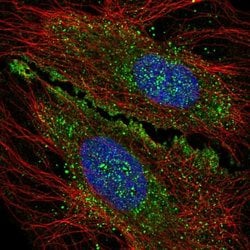 Invitrogen KIAA1644 Polyclonal Antibody 100 &mu;L; Unconjugated:Antibodies,