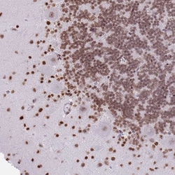 Invitrogen KIAA1644 Polyclonal Antibody 100 &mu;L; Unconjugated:Antibodies,