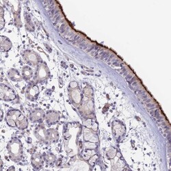 Invitrogen NDUFAF5 Polyclonal Antibody 100 &mu;L; Unconjugated:Antibodies,