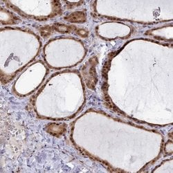 Invitrogen GINS1 Polyclonal Antibody 100 &mu;L; Unconjugated:Antibodies,