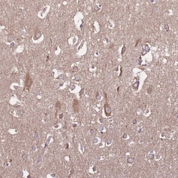 KIF16B Polyclonal Antibody:Antibodies, Polyclonal