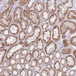 KIF16B Polyclonal Antibody:Antibodies, Polyclonal