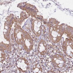 KIF16B Polyclonal Antibody:Antibodies, Polyclonal