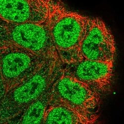 Invitrogen RASSF2 Polyclonal Antibody 100 &mu;L | Buy Online | Invitrogen&trade; | Fisher Scientific