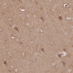 Invitrogen RASSF2 Polyclonal Antibody 100 &mu;L | Buy Online | Invitrogen&trade; | Fisher Scientific