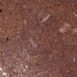 Invitrogen RASSF2 Polyclonal Antibody 100 &mu;L | Buy Online | Invitrogen&trade; | Fisher Scientific