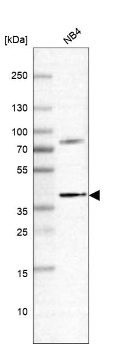 Invitrogen RASSF2 Polyclonal Antibody 100 &mu;L | Buy Online | Invitrogen&trade; | Fisher Scientific