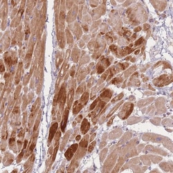 Invitrogen TMOD1 Polyclonal Antibody 100 &mu;L; Unconjugated:Antibodies,