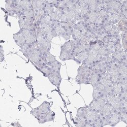 Invitrogen TMOD1 Polyclonal Antibody 100 &mu;L; Unconjugated:Antibodies,