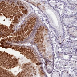 Invitrogen KCNT2 Polyclonal Antibody 100 &mu;L; Unconjugated:Antibodies,
