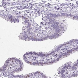 Invitrogen SPC24 Polyclonal Antibody 100 &mu;L; Unconjugated:Antibodies,