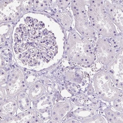 Invitrogen SPC24 Polyclonal Antibody 100 &mu;L; Unconjugated:Antibodies,