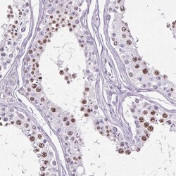 Invitrogen SPC24 Polyclonal Antibody 100 &mu;L; Unconjugated:Antibodies,