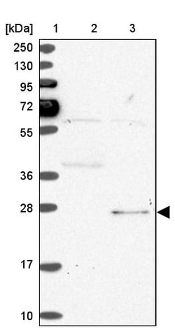Invitrogen SPC24 Polyclonal Antibody 100 &mu;L; Unconjugated:Antibodies,