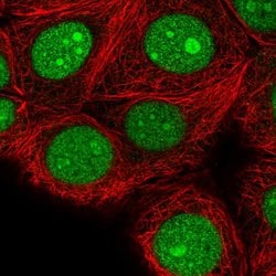Invitrogen SPC24 Polyclonal Antibody 100 &mu;L; Unconjugated:Antibodies,