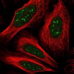 Invitrogen KIAA1841 Polyclonal Antibody 100 &mu;L; Unconjugated:Antibodies,