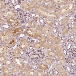 Invitrogen SLC34A1 Polyclonal Antibody 100 &mu;L; Unconjugated:Antibodies,
