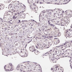 Invitrogen SLC34A1 Polyclonal Antibody 100 &mu;L; Unconjugated:Antibodies,