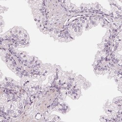 Invitrogen SLC34A1 Polyclonal Antibody 100 &mu;L; Unconjugated:Antibodies,
