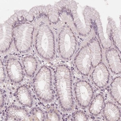 Invitrogen SLC34A1 Polyclonal Antibody 100 &mu;L; Unconjugated:Antibodies,