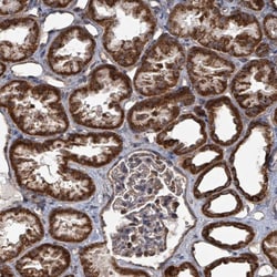 Invitrogen MRPL4 Polyclonal Antibody 100 &mu;L | Buy Online | Invitrogen&trade; | Fisher Scientific