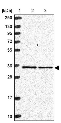 Invitrogen MRPL4 Polyclonal Antibody 100 &mu;L | Buy Online | Invitrogen&trade; | Fisher Scientific