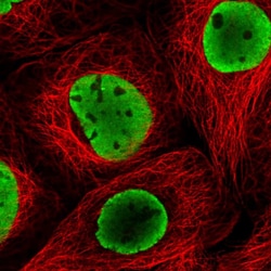 Invitrogen SAM68 Polyclonal Antibody 100 &mu;L; Unconjugated:Antibodies,