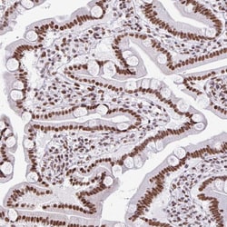 Invitrogen SAM68 Polyclonal Antibody 100 &mu;L; Unconjugated:Antibodies,
