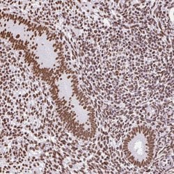 Invitrogen SAM68 Polyclonal Antibody 100 &mu;L; Unconjugated:Antibodies,