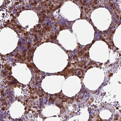 Invitrogen TMEM8A Polyclonal Antibody 100 &mu;L; Unconjugated:Antibodies,