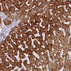Invitrogen PRODH2 Polyclonal Antibody 100 &mu;L | Buy Online | Invitrogen&trade; | Fisher Scientific