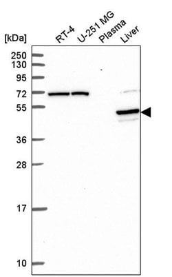 Invitrogen PRODH2 Polyclonal Antibody 100 &mu;L | Buy Online | Invitrogen&trade; | Fisher Scientific