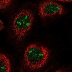 Invitrogen ANKRD18A Polyclonal Antibody 100 &mu;L; Unconjugated:Antibodies,